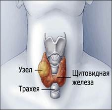 УЗИ щитовидной железы